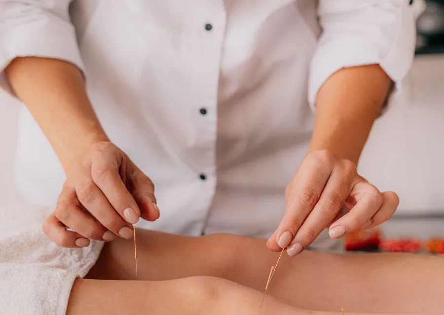 Acupuncture treatment with needles